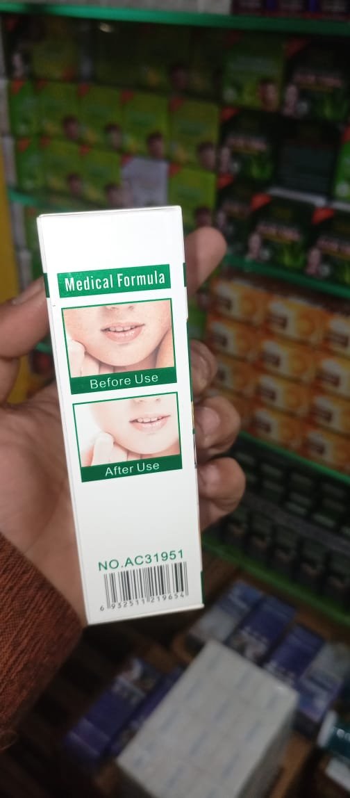 Anti-Freckle Whitening Facial Serum - Image 3