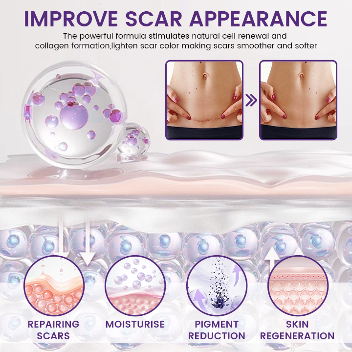 Timilk Regenscar Stem Cell Scar Gel 20g Triple Action Formula for Old - Image 4