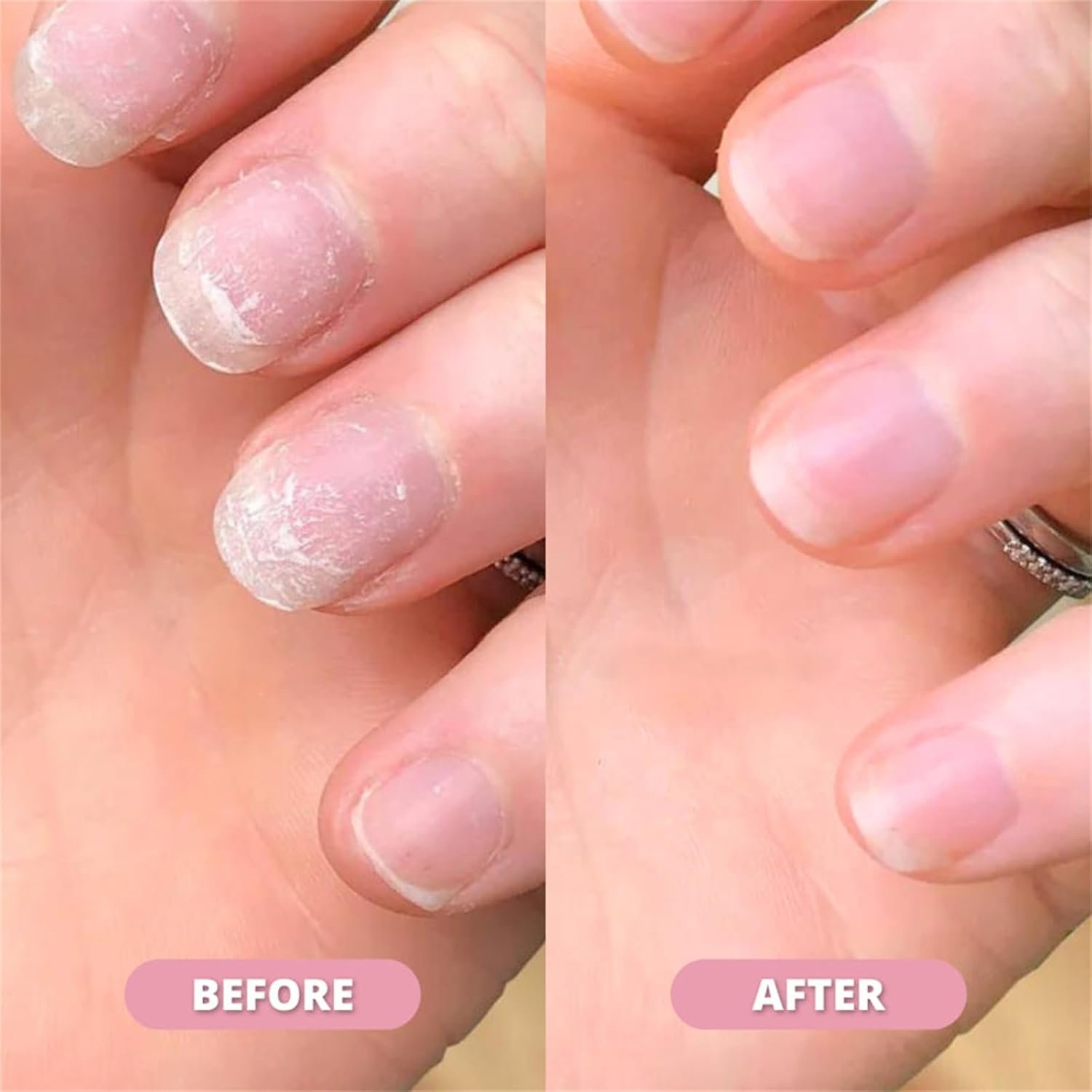 Nail Growth & Cuticle Oil Pen - Image 3