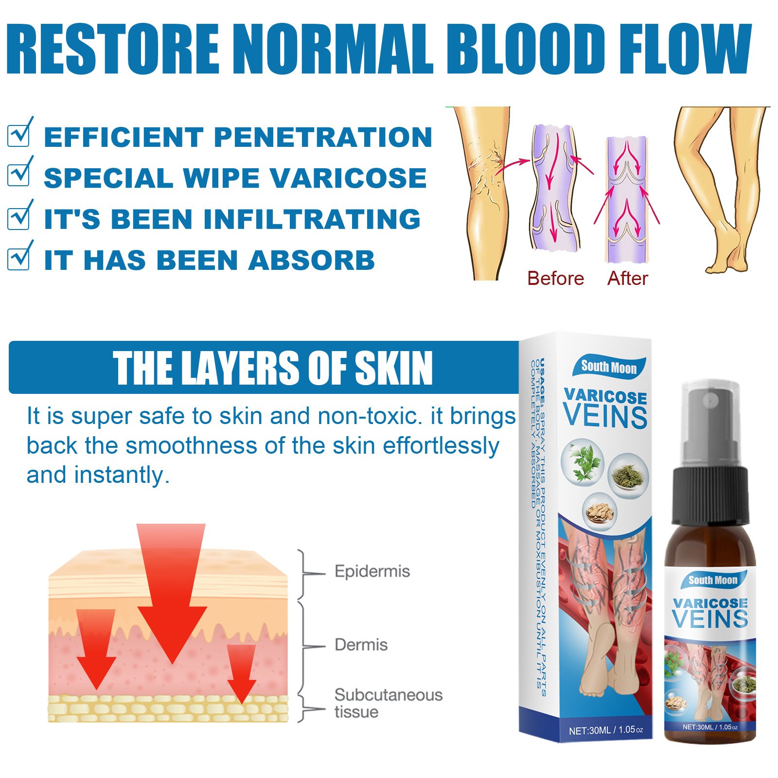 30Ml Varicose Veins Treatment Spray Varicose Vein Treatment Cream...