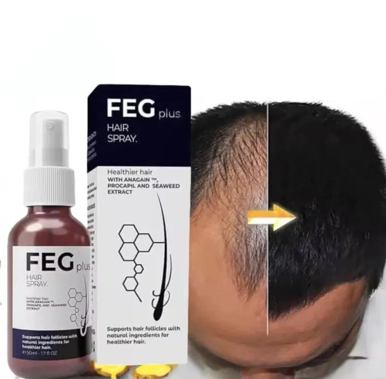 Feg Plus Hair & Beard Regrowth Spray - Image 5