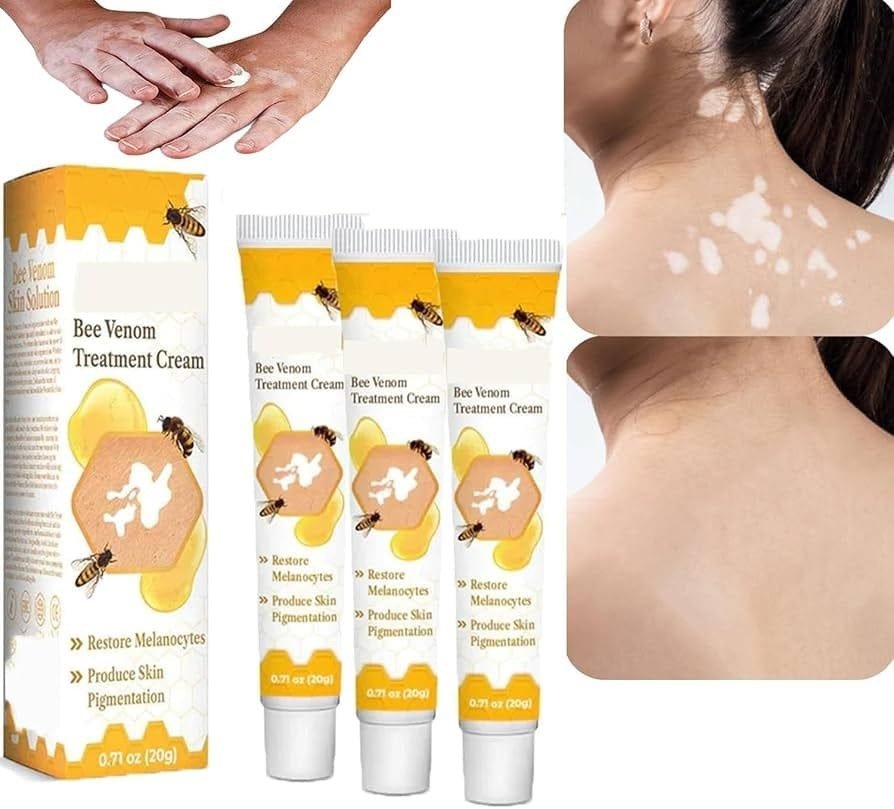 Fivfivgo™ Vitigo Bee Venom Correcting Cream (20g) Support for Skin - Image 3