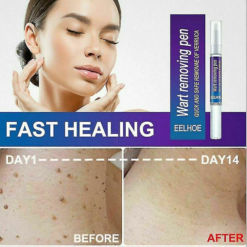 Warts Remover Original Cream Wart Removal Ointment Wart Treatment...