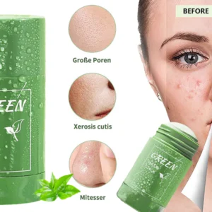 The Magic Green Stick Mask