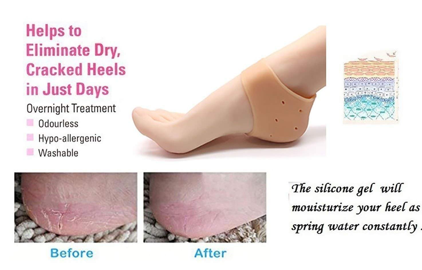 Silicone Anti-Crack Half Heel Socks Set - Image 3