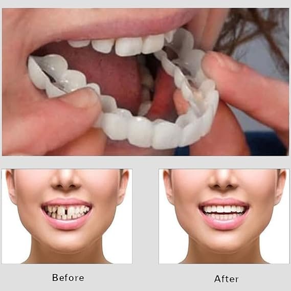 Snap On Smile - Veneers Teeth For Men And Women - Moldable False...