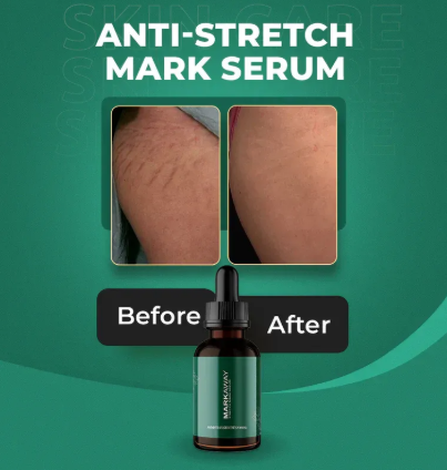 Markaway Stretch Mark Serum - Image 3