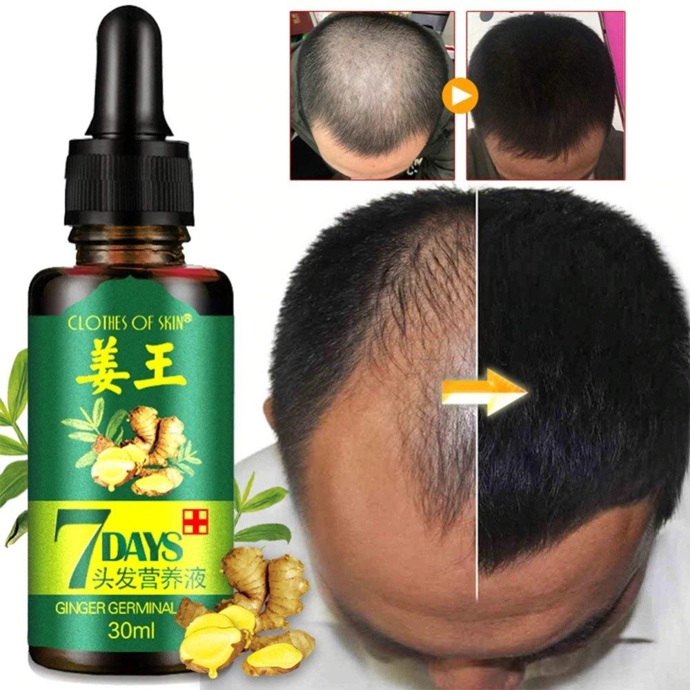 7 Day Ginger Germinal Oil Hair Nutrient Solution Hair Growth... - Image 3