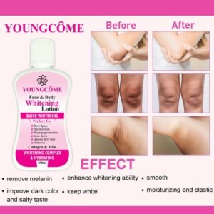 Youngcome 60Ml Face Body Whitening Lotion Underarm Brightening...