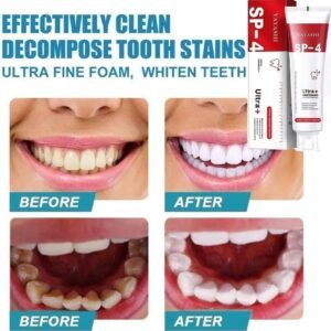 Premium Yayashi Sp-4 Ultra Whitening Probiotic Toothpaste