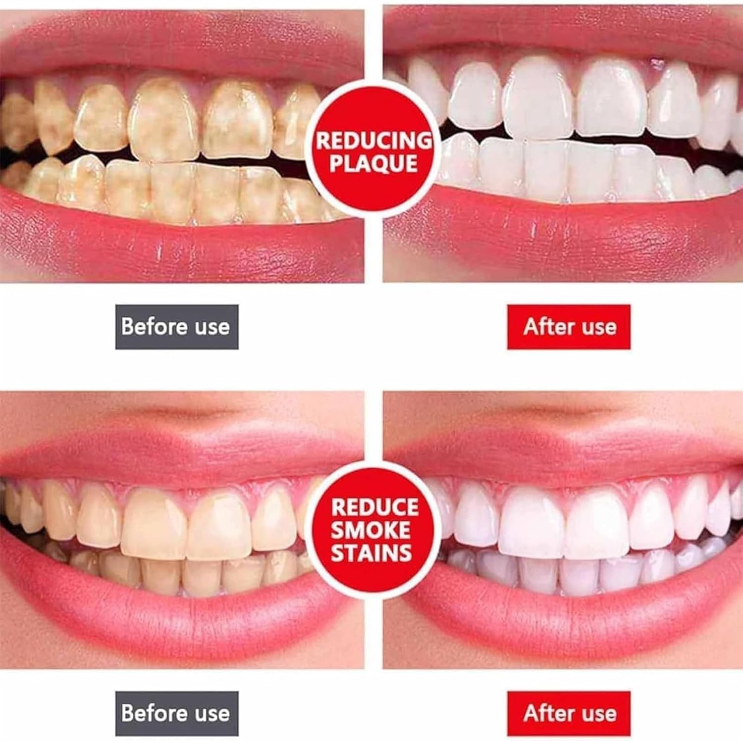 Yayashi Sp-4 Ultra Whitening Toothpaste Probiotic Stain Remover... - Image 3