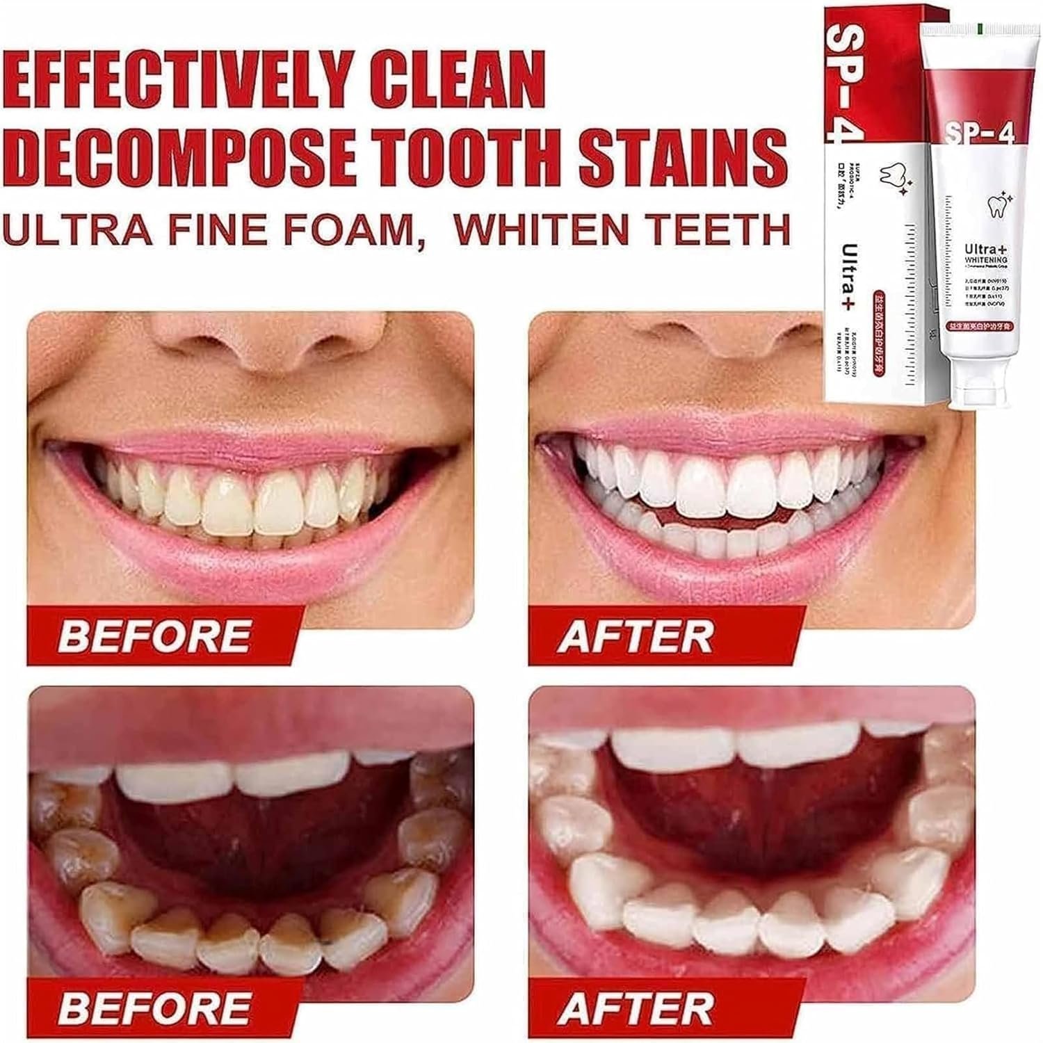 Yayashi Sp-4 Ultra Whitening Toothpaste Probiotic Stain Remover... - Image 4