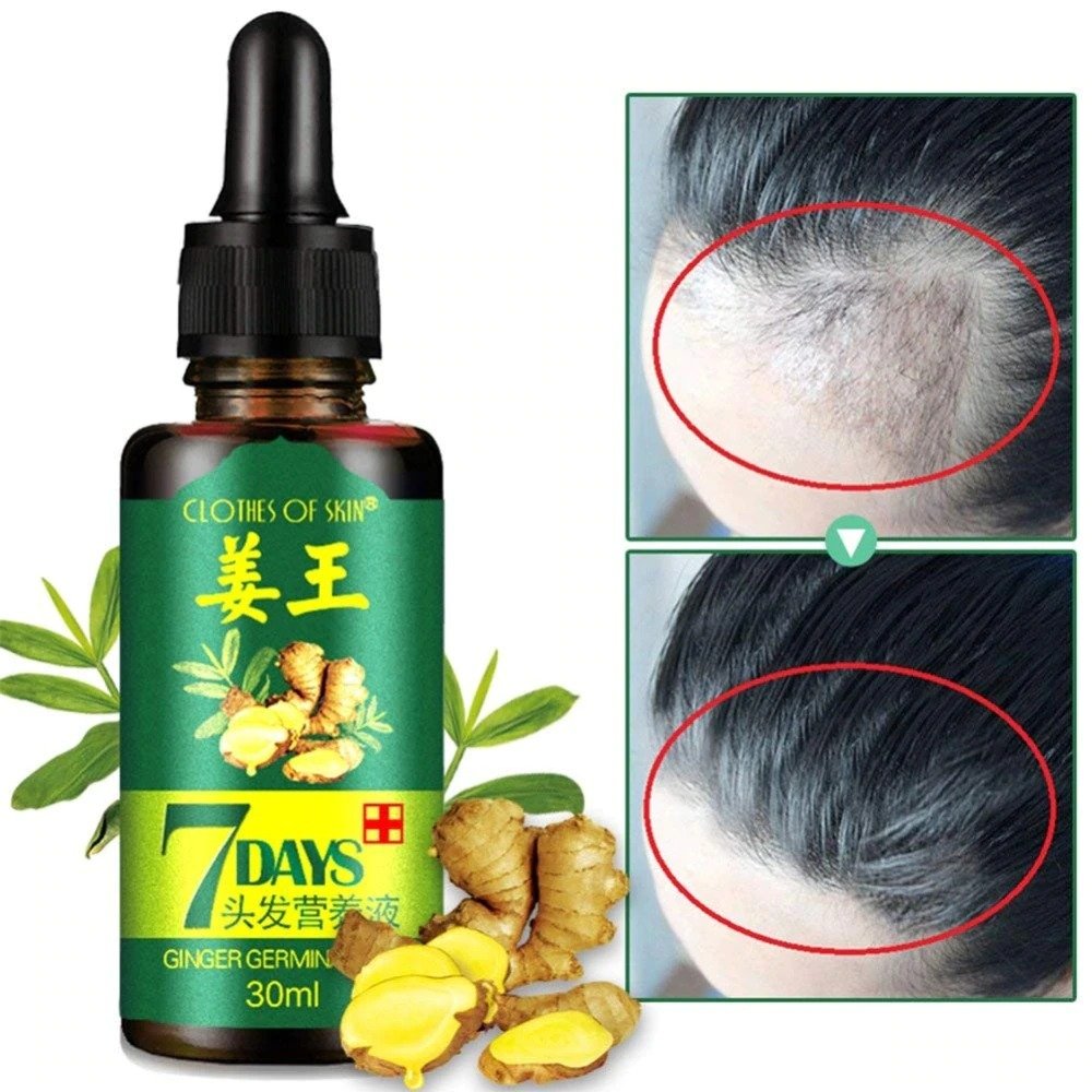 7 Day Ginger Germinal Oil Hair Nutrient Solution Hair Growth...