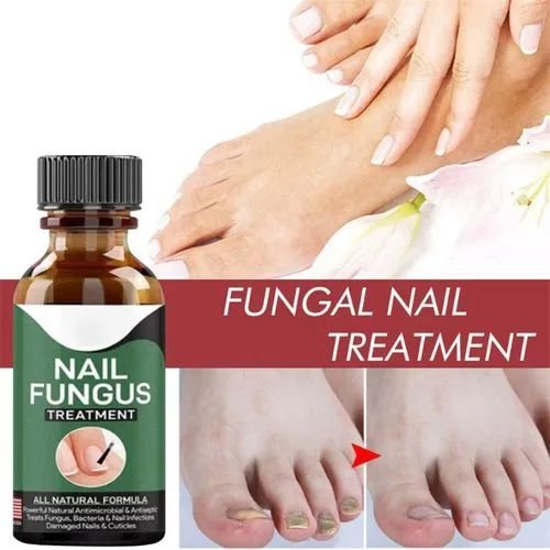 Fast Nail Fungal Treatments Nail Repair Essences Serum Care...