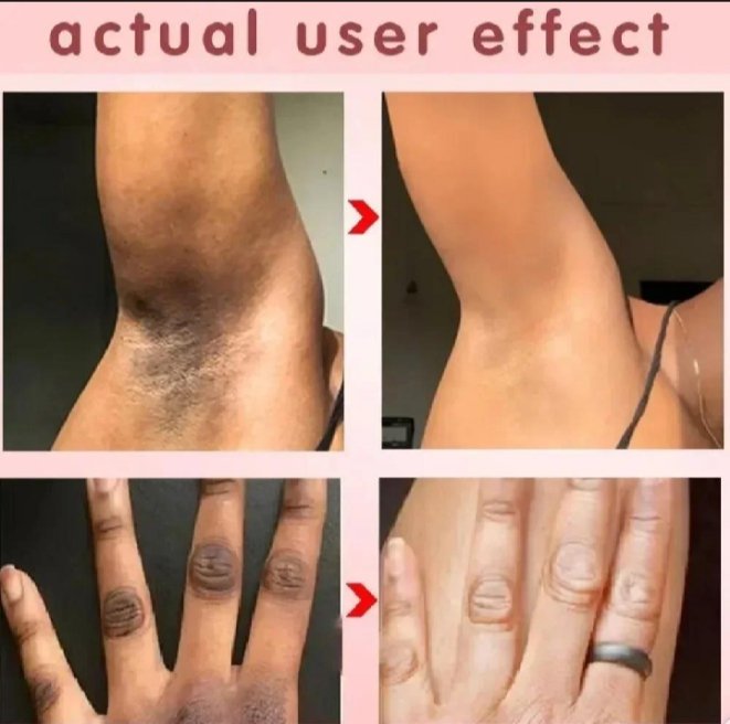 Whitening Cream For Sensitive Areas Underarm And Private Areas - 30G - Image 4