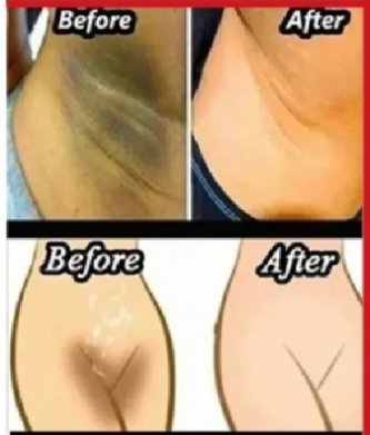 Whitening Cream For Sensitive Areas Underarm And Private Areas - 30G - Image 3