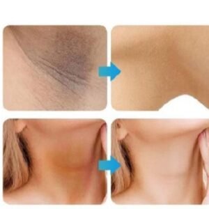 Whitening Cream For Sensitive Areas Underarm And Private Areas - 30G