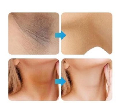 Whitening Cream For Sensitive Areas Underarm And Private Areas - 30G