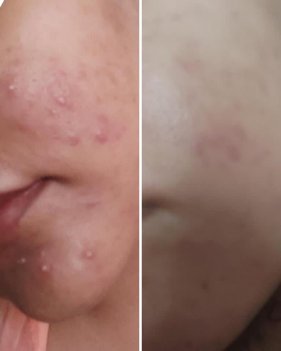 Nirvana Botanics- Vitamin C &Amp; E Serum 15Ml - Image 2