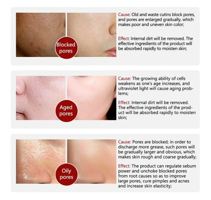 Rorec Moisturizing Anti Wrinkle Rice Face Serum For Open Pores 15Ml - Image 4